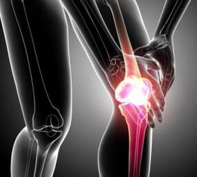 bolest kolena při artritidě a artróze