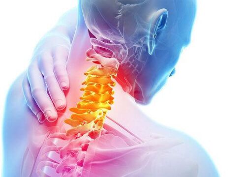 spinální léze s cervikální osteochondrózou
