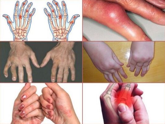 bolest v kloubech prstů