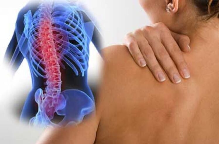 Během exacerbace osteochondrózy hrudní páteře dochází k bolesti dorsago