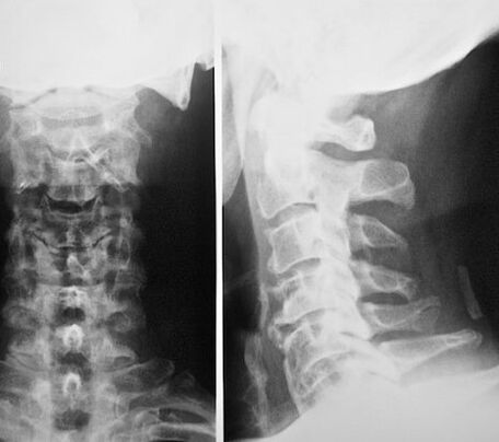 Radiografie