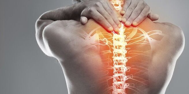 Lékařské možnosti pro cervikální terapii děložní osteochondózy