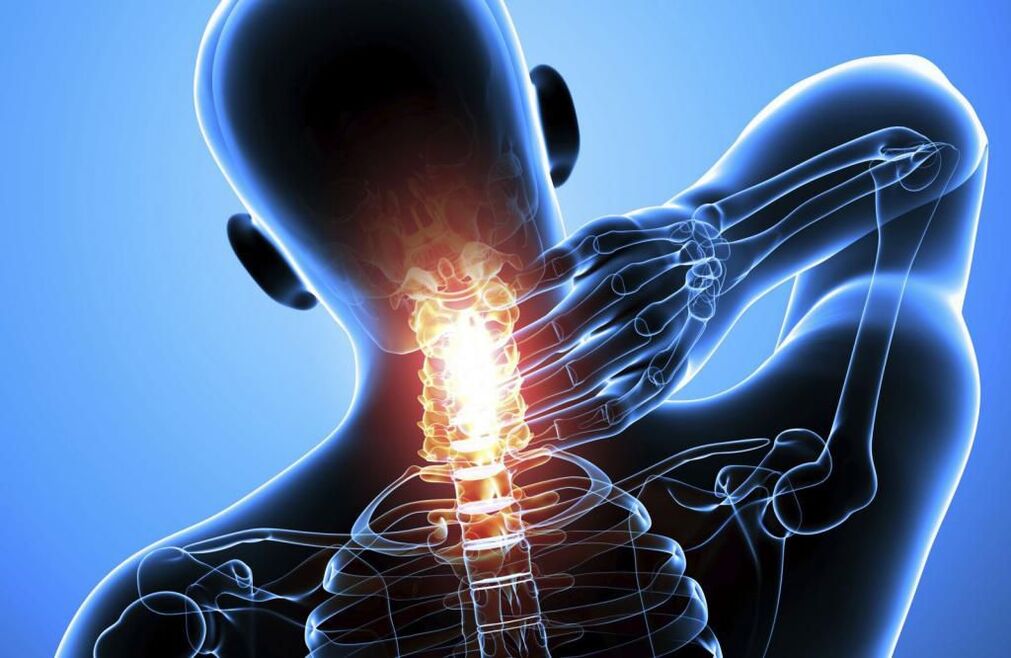 Osteochondroza krční páteře
