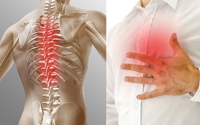 Hrudní osteochondróza se projevuje bolestí a pocitem tísně na hrudi